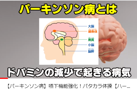 パーキンソン病での訪問マッサージ