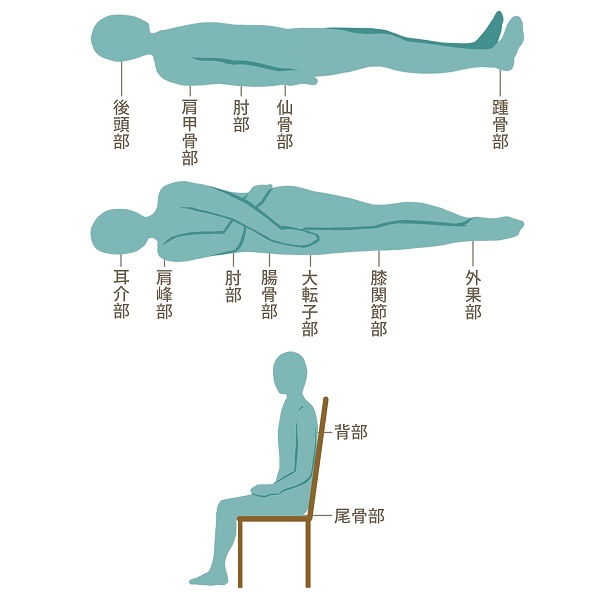 廃用症候群（寝たきり）に褥瘡予防やポジショニング